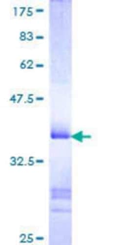 Novus Biologicals Recombinant Human ZKSCAN3 GST (N-Term) Protein 10 &mu;g | Buy Online | Novus Biologicals&trade; | Fisher Scientific