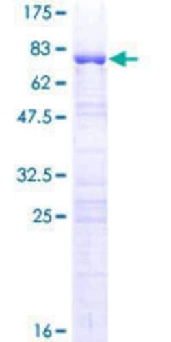 Novus Biologicals Recombinant Human GKAP1 GST (N-Term) Protein 10 &mu;g | Buy Online | Novus Biologicals&trade; | Fisher Scientific