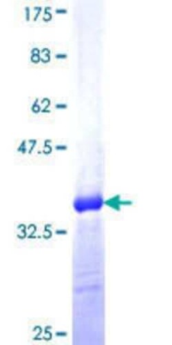 Novus Biologicals Recombinant Human SP6 GST (N-Term) Protein 10 &mu;g | Buy Online | Novus Biologicals&trade; | Fisher Scientific