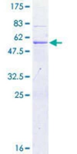 Novus Biologicals Recombinant Human CSP GST (N-Term) Protein 10 &mu;g | Buy Online | Novus Biologicals&trade; | Fisher Scientific