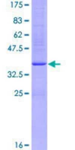 Novus Biologicals Recombinant Human ADAM33 GST (N-Term) Protein 25 &mu;g | Buy Online | Novus Biologicals&trade; | Fisher Scientific