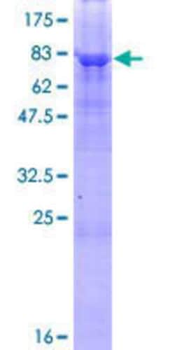 Novus Biologicals Recombinant Human Adiponutrin/PNPLA3 GST (N-Term) Protein 10 &mu;g | Buy Online | Novus Biologicals&trade; | Fisher Scientific