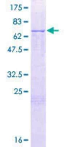 Novus Biologicals Recombinant Human BPIL1 GST (N-Term) Protein 2 &mu;g | Buy Online | Novus Biologicals&trade; | Fisher Scientific