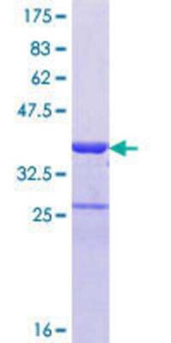 Novus Biologicals Recombinant Human TRAF3IP3 GST (N-Term) Protein 25 &mu;g | Buy Online | Novus Biologicals&trade; | Fisher Scientific