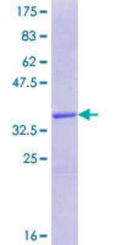 Novus Biologicals Recombinant Human RNF39 GST (N-Term) Protein 25 &mu;g | Buy Online | Novus Biologicals&trade; | Fisher Scientific