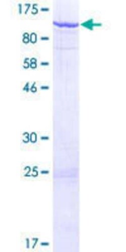 Novus Biologicals Recombinant Human TSGA10 GST (N-Term) Protein 2 &mu;g | Buy Online | Novus Biologicals&trade; | Fisher Scientific