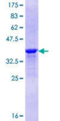 Novus Biologicals Recombinant Human AKNA GST (N-Term) Protein 25 &mu;g | Buy Online | Novus Biologicals&trade; | Fisher Scientific