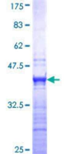 Novus Biologicals Recombinant Human ESX1 GST (N-Term) Protein 10 &mu;g | Buy Online | Novus Biologicals&trade; | Fisher Scientific
