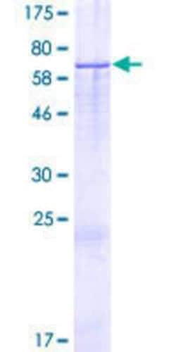 Novus Biologicals Recombinant Human IQCN GST (N-Term) Protein 2 &mu;g | Buy Online | Novus Biologicals&trade; | Fisher Scientific