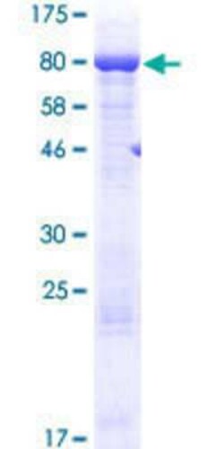 Novus Biologicals Recombinant Human AARSD1 GST (N-Term) Protein 10 &mu;g | Buy Online | Novus Biologicals&trade; | Fisher Scientific