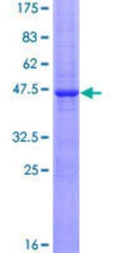 Novus Biologicals Recombinant Human Cytochrome b5 Outer Mitochondrial Membrane GST (N-Term) Protein 25 &mu;g | Buy Online | Novus Biologicals&trade; | Fisher Scientific