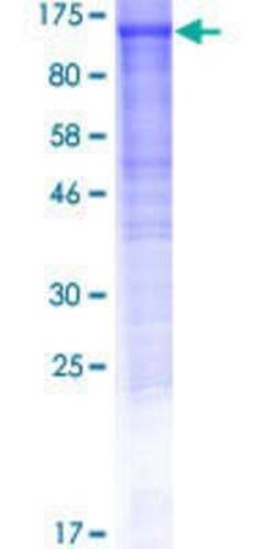 Novus Biologicals Recombinant Human DDHD1 GST (N-Term) Protein 10 &mu;g | Buy Online | Novus Biologicals&trade; | Fisher Scientific