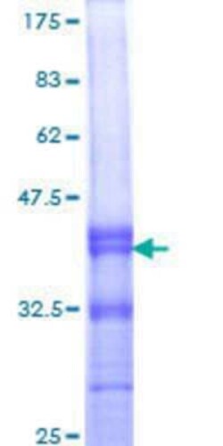 Novus Biologicals Recombinant Human APOL3 GST (N-Term) Protein 25 &mu;g | Buy Online | Novus Biologicals&trade; | Fisher Scientific