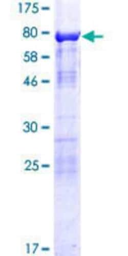 Novus Biologicals Recombinant Human SH3BP5L GST (N-Term) Protein 10 &mu;g | Buy Online | Novus Biologicals&trade; | Fisher Scientific
