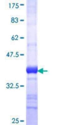 Novus Biologicals Recombinant Human ILKAP/PP2C delta GST (N-Term) Protein 25 &mu;g | Buy Online | Novus Biologicals&trade; | Fisher Scientific