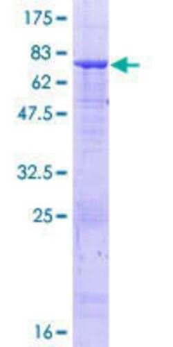 Novus Biologicals Recombinant Human beta I Tubulin GST (N-Term) Protein 25 &mu;g | Buy Online | Novus Biologicals&trade; | Fisher Scientific