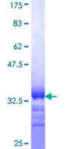 Novus Biologicals Recombinant Human GLUT10 GST (N-Term) Protein 25 &mu;g | Buy Online | Novus Biologicals&trade; | Fisher Scientific