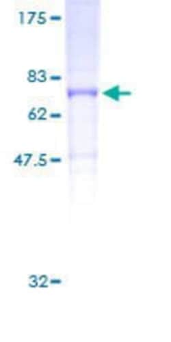 Novus Biologicals Recombinant Human Kv11.2 GST (N-Term) Protein 2 &mu;g | Buy Online | Novus Biologicals&trade; | Fisher Scientific