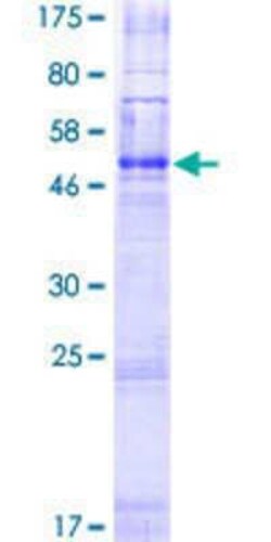 Novus Biologicals Recombinant Human OR2G2 GST (N-Term) Protein 25 &mu;g | Buy Online | Novus Biologicals&trade; | Fisher Scientific