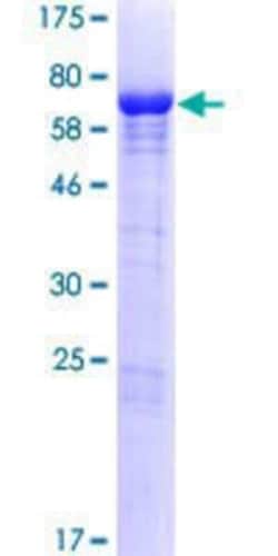 Novus Biologicals&trade;&nbsp;Recombinant Human GRINL1A GST (N-Term) Protein