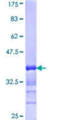 Novus Biologicals Recombinant Human RSHL1 GST (N-Term) Protein 25 &mu;g | Buy Online | Novus Biologicals&trade; | Fisher Scientific