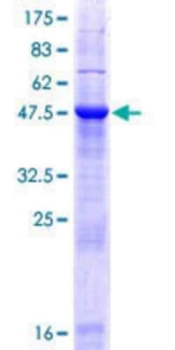 Novus Biologicals&trade;&nbsp;Recombinant Human HCCA2 GST (N-Term) Protein