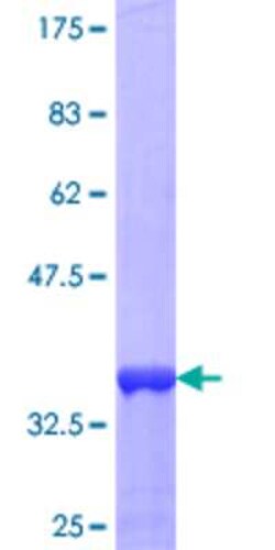 Novus Biologicals Recombinant Human Trim11 GST (N-Term) Protein 25 &mu;g | Buy Online | Novus Biologicals&trade; | Fisher Scientific