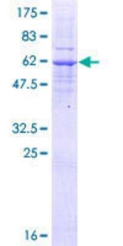 Novus Biologicals Recombinant Human LMAN2L GST (N-Term) Protein 10 &mu;g | Buy Online | Novus Biologicals&trade; | Fisher Scientific