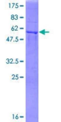 Novus Biologicals Recombinant Human GFOD2 GST (N-Term) Protein 25 &mu;g | Buy Online | Novus Biologicals&trade; | Fisher Scientific