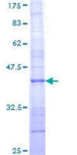 Novus Biologicals Recombinant Human Collagen XXI GST (N-Term) Protein 10 &mu;g | Buy Online | Novus Biologicals&trade; | Fisher Scientific