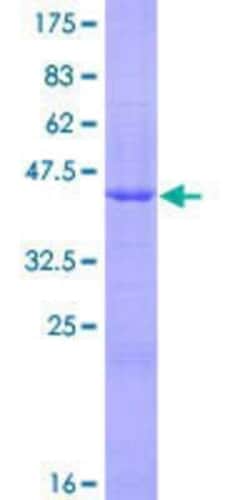 Novus Biologicals Recombinant Human Phospholipase A2 XII GST (N-Term) Protein 10 &mu;g | Buy Online | Novus Biologicals&trade; | Fisher Scientific
