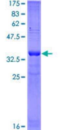 Novus Biologicals Recombinant Human Phospholipase A2 XII GST (N-Term) Protein 25 &mu;g | Buy Online | Novus Biologicals&trade; | Fisher Scientific