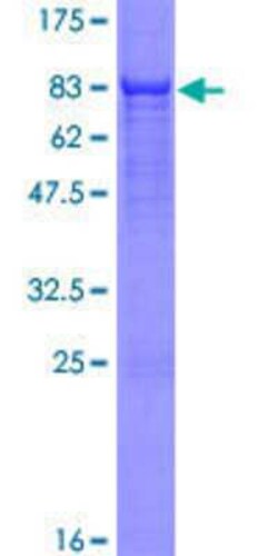 Novus Biologicals&trade;&nbsp;Recombinant Human CDADC1 GST (N-Term) Protein