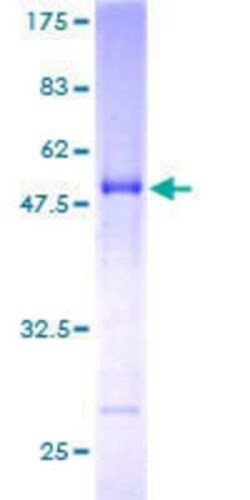 Novus Biologicals Recombinant Human SNX27 GST (N-Term) Protein 10 &mu;g | Buy Online | Novus Biologicals&trade; | Fisher Scientific