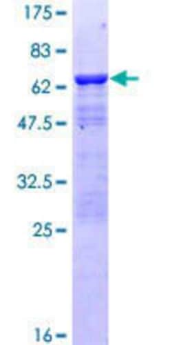 Novus Biologicals Recombinant Human LANPL GST (N-Term) Protein 25 &mu;g | Buy Online | Novus Biologicals&trade; | Fisher Scientific