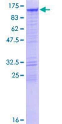 Novus Biologicals Recombinant Human DIAPH3 GST (N-Term) Protein 10 &mu;g | Buy Online | Novus Biologicals&trade; | Fisher Scientific