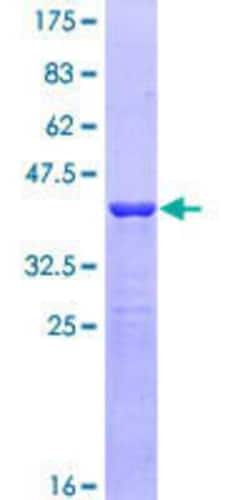 Novus Biologicals Recombinant Human DIAPH3 GST (N-Term) Protein 10 &mu;g | Buy Online | Novus Biologicals&trade; | Fisher Scientific