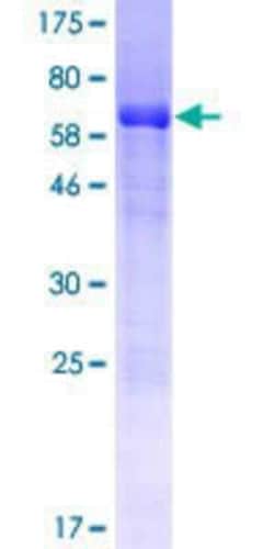 Novus Biologicals Recombinant Human TSC22D4 GST (N-Term) Protein 25 &mu;g | Buy Online | Novus Biologicals&trade; | Fisher Scientific