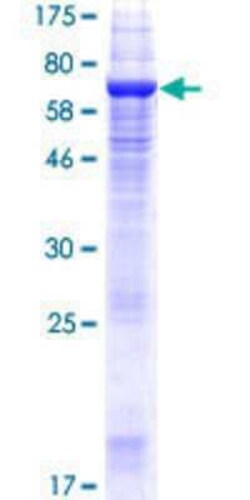 Novus Biologicals Recombinant Human TMEM49 GST (N-Term) Protein 10 &mu;g | Buy Online | Novus Biologicals&trade; | Fisher Scientific