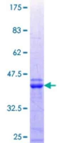 Novus Biologicals Recombinant Human NUAK2 GST (N-Term) Protein 25 &mu;g | Buy Online | Novus Biologicals&trade; | Fisher Scientific