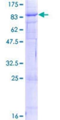 Novus Biologicals Recombinant Human Vang-like Protein 1/VANGL1 GST (N-Term) Protein 10 &mu;g | Buy Online | Novus Biologicals&trade; | Fisher Scientific