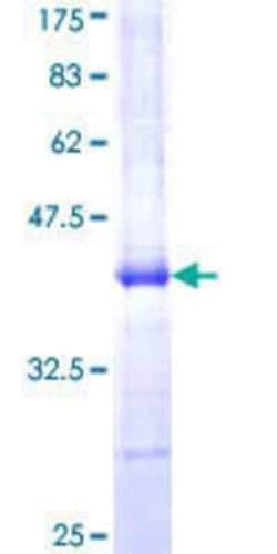 Novus Biologicals Recombinant Human TRIM56 GST (N-Term) Protein 25 &mu;g | Buy Online | Novus Biologicals&trade; | Fisher Scientific