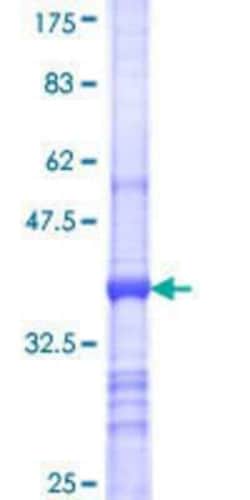 Novus Biologicals Recombinant Human SBF2 GST (N-Term) Protein 25 &mu;g | Buy Online | Novus Biologicals&trade; | Fisher Scientific