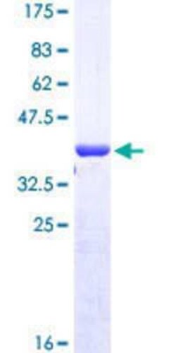 Novus Biologicals Recombinant Human RNF146 GST (N-Term) Protein 10 &mu;g | Buy Online | Novus Biologicals&trade; | Fisher Scientific