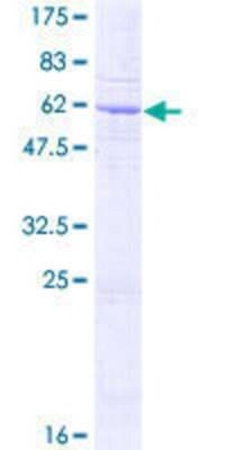 Novus Biologicals Recombinant Human SFXN3 GST (N-Term) Protein 25 &mu;g | Buy Online | Novus Biologicals&trade; | Fisher Scientific