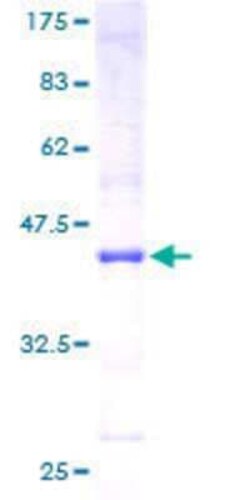 Novus Biologicals&trade;&nbsp;Recombinant Human ZNF611 GST (N-Term) Protein