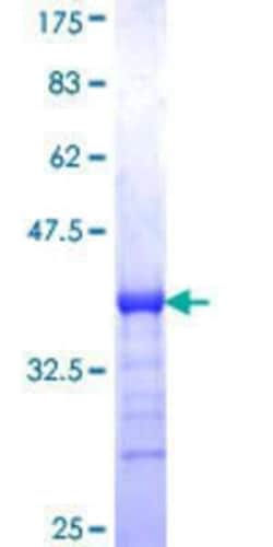 Novus Biologicals Recombinant Human SHARPIN GST (N-Term) Protein 25 &mu;g | Buy Online | Novus Biologicals&trade; | Fisher Scientific