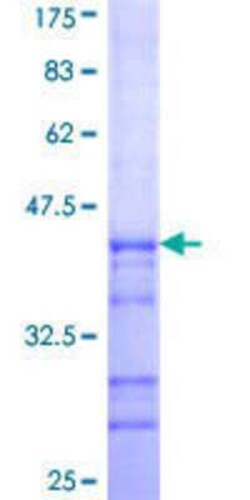 Novus Biologicals Recombinant Human ARPC5L GST (N-Term) Protein 25 &mu;g | Buy Online | Novus Biologicals&trade; | Fisher Scientific