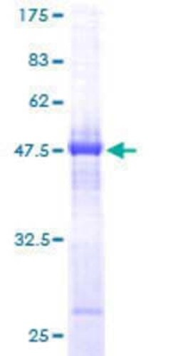 Novus Biologicals&trade;&nbsp;Recombinant Human HYI GST (N-Term) Protein