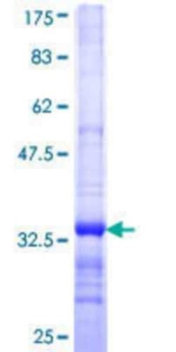 Novus Biologicals Recombinant Human ADPGK GST (N-Term) Protein 25 &mu;g | Buy Online | Novus Biologicals&trade; | Fisher Scientific